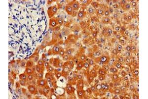 Immunohistochemistry of paraffin-embedded human liver tissue using ABIN7144675 at dilution of 1:100