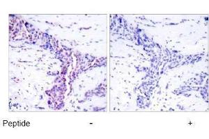 Image no. 1 for anti-Activating Transcription Factor 2 (ATF2) (Thr55), (Thr73) antibody (ABIN197151) (ATF2 Antikörper  (Thr55, Thr73))