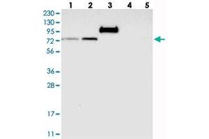 Western blot analysis of Lane 1: RT-4, Lane 2: U-251 MG, Lane 3: Human Plasma, Lane 4: Liver, Lane 5: Tonsil with GARNL4 polyclonal antibody  at 1:250-1:500 dilution. (RAP1GAP2 Antikörper)