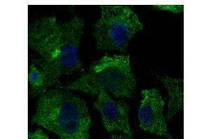 Anti-Calnexin Ab at 1/500 dilution, lysates at 50 per Iane, rabbit polyclonal to goat lµg (HRP) at 1/10,000 dilution, (Caveolin-1 Antikörper  (N-Term))