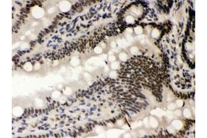 IHC testing of FFPE rat intestine with CSNK1A1 antibody. (CSNK1A1 Antikörper)