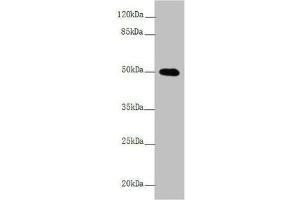 Western blot All lanes: L2HGDH antibody at 4. (L2HGDH Antikörper  (AA 1-220))