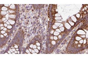 ABIN6272937 at 1/100 staining Mouse colon tissue by IHC-P. (BBS2 Antikörper  (C-Term))