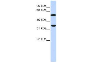 WB Suggested Anti-C4B Antibody Titration:  0. (C4B Antikörper  (N-Term))