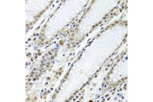Immunohistochemistry of paraffin-embedded human stomach using TIA1 antibody (ABIN6293426) at dilution of 1:100 (40x lens).
