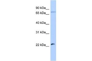Host:  Rabbit  Target Name:  HSFY2  Sample Type:  Jurkat Whole Cell lysates  Antibody Dilution:  1. (HSFY2 Antikörper  (Middle Region))