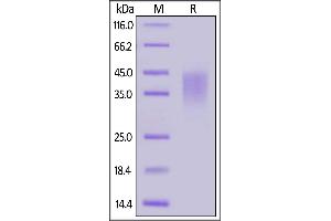 Biotinylated Human / Cynomolgus / Rhesus macaque CD28, His,Avitag on  under reducing (R) condition.