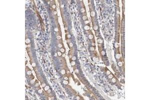 Immunohistochemical staining of human duodenum with PSMG3 polyclonal antibody  shows cytoplasmic positivity in glandular cells.