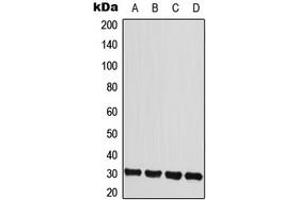 Western blot analysis of IL-22RA2 expression in HeLa (A), MCF7 (B), mouse heart (C), rat heart (D) whole cell lysates. (IL22RA2 Antikörper  (Center))