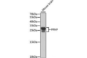Western blot analysis of extracts of Mouse brain using PRNP Polyclonal Antibody at dilution of 1:1000. (PRNP Antikörper)