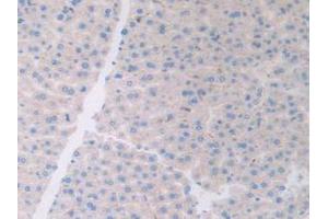 Figure. (ATF6 Antikörper  (AA 1-377))