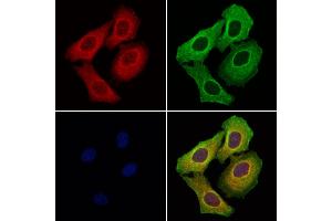 ABIN6257549 and ABIN6276234 staining Hela cells by IF/ICC. (VIPR1 Antikörper  (Internal Region))