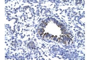 Rabbit Anti-KIF5A antibody   Paraffin Embedded Tissue: Human Lung cell Cellular Data: bronchiole epithelium of renal tubule Antibody Concentration: 4. (KIF5A Antikörper  (Middle Region))