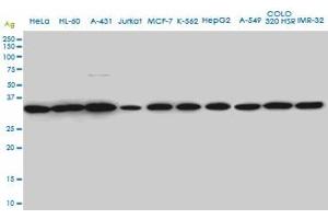 SUPT3H monoclonal antibody (M01A), clone 1A6 Western Blot analysis of SUPT3H expression in HeLa . (SUPT3H/SPT3 Antikörper  (AA 1-328))
