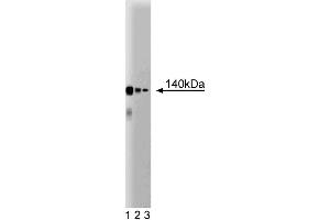 Western blot analysis of CTCF on a Jurkat cell lysate (Human T-cell leukemia, ATCC TIB-152). (CTCF Antikörper  (AA 184-290))