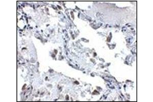 Immunohistochemistry of SH3BP4 in human lung tissue with this product at 5 μg/ml. (SH3BP4 Antikörper  (C-Term))