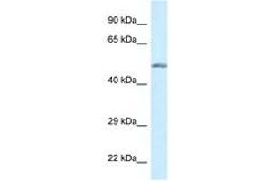 Image no. 1 for anti-Glucokinase (Hexokinase 4) (GCK) (AA 84-133) antibody (ABIN6747601) (GCK Antikörper  (AA 84-133))