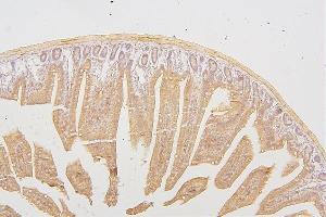 IHC analysis of PRKCD using anti-PRKCD antibody (ABIN7601631). (PKC delta Antikörper  (AA 4-676))