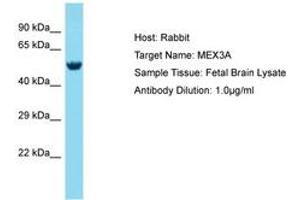 Image no. 1 for anti-Mex-3 Homolog A (MEX3A) (AA 172-221) antibody (ABIN6750731) (MEX3A Antikörper  (AA 172-221))