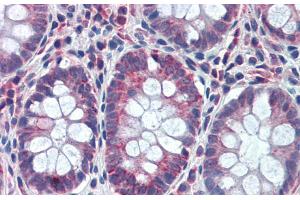 Rabbit Anti-GATA6 Antibody Catalog Number: ARP31859 Paraffin Embedded Tissue: Human Colon Antibody Concentration: 5 ug/ml