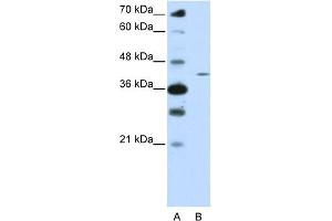 WB Suggested Anti-ZNF488 Antibody Titration:  0. (ZNF488 Antikörper  (N-Term))