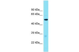 Host: Rabbit  Target Name: Glp1r  Sample Tissue: Mouse Liver lysates  Antibody Dilution: 1. (GLP1R Antikörper  (Middle Region))