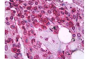 Anti-CD45RO antibody IHC of human spleen, t lymphocytes. (CD45RO Antikörper)