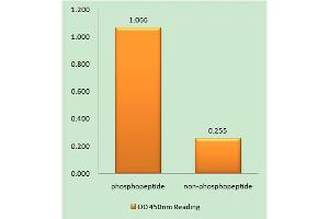 Immunohistochemistry analysis of paraffin-embedded human brain tissue using Ephrin B1/B2 (Phospho-Tyr329) antibody. (Ephrin B1/B2 (pTyr329) Antikörper)