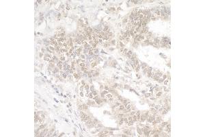 Immunohistochemistry (IHC) image for anti-Ankyrin Repeat-Containing Protein (EHMT2) (C-Term) antibody (ABIN7453554) (EHMT2 Antikörper  (C-Term))