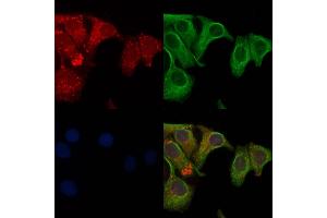 ABIN6261041 and ABIN6272826 staining Hela cells by IF/ICC. (CRMP1 Antikörper  (C-Term))