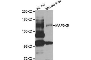 Western blot analysis of extracts of various cell lines, using MAP3K5 antibody. (ASK1 Antikörper  (AA 1175-1374))