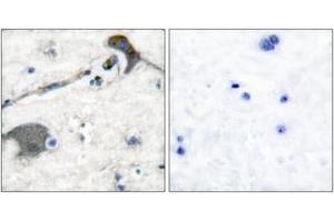 Immunohistochemistry analysis of paraffin-embedded human brain tissue, using RASH/RASK Antibody. (RASH/RASK (AA 1-50) Antikörper)