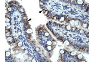 Immunohistochemical staining (Formalin-fixed paraffin-embedded sections) of human intestine with KRT15 polyclonal antibody . (KRT15 Antikörper  (AA 407-456))