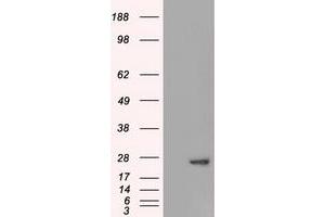 Western Blotting (WB) image for anti-Adenylate Kinase 1 (AK1) antibody (ABIN1496517) (Adenylate Kinase 1 Antikörper)