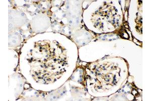 Immunohistochemistry (IHC) image for anti-Lectin, Galactoside-Binding, Soluble, 1 (LGALS1) (AA 2-135) antibody (ABIN5518716)