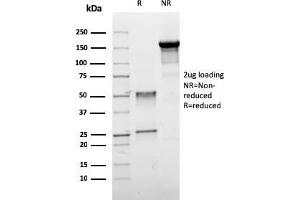 SDS-PAGE Analysis Purified ER-beta Mouse Monoclonal Antibody (ESR2/3005). (ESR2 Antikörper)