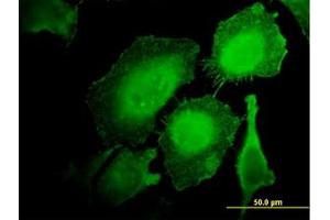 Image no. 2 for anti-Hematopoietic Cell-Specific Lyn Substrate 1 (HCLS1) (AA 266-356) antibody (ABIN598726) (HCLS1 Antikörper  (AA 266-356))