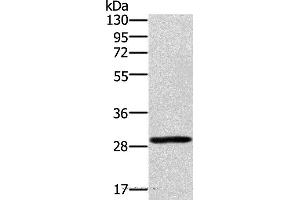 Western blot analysis of 293T cell, using EDA2R Polyclonal Antibody at dilution of 1:450 (Ectodysplasin A2 Receptor Antikörper)