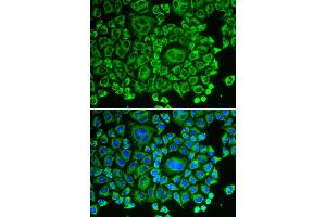 Immunofluorescence analysis of HeLa cell using ARHGDIA antibody.