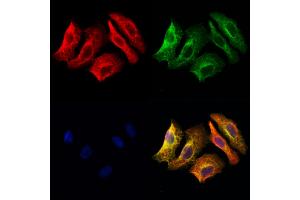 ABIN6262752 and ABIN6278170 staining Hela cells by IF/ICC.