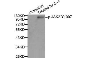 Western Blotting (WB) image for anti-Janus Kinase 2 (JAK2) (pTyr1007) antibody (ABIN3020271) (JAK2 Antikörper  (pTyr1007))