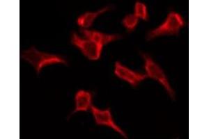 ABIN6276149 staining HeLa by IF/ICC. (OR4C6 Antikörper  (Internal Region))