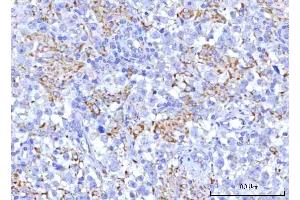 IHC analysis of PTPIP51/RMDN3 using anti-PTPIP51/RMDN3 antibody (ABIN7601775). (RMDN3 Antikörper  (AA 45-438))