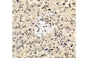Immunohistochemistry of paraffin embedded rat placenta using notch3 (ABIN7074862) at dilution of 1:700 (250x lens) (NOTCH3 Antikörper)