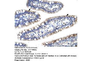Human Intestine (KLHL13 Antikörper  (N-Term))
