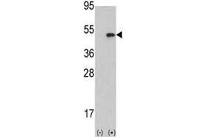 Western blot analysis of Aurora B antibody and 293 cell lysate (2 ug/lane) either nontransfected (Lane 1) or transiently transfected with the AURKB gene (2). (Aurora Kinase B Antikörper  (AA 6-35))