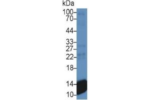 Western Blotting (WB) image for Pro-Platelet Basic Protein (Chemokine (C-X-C Motif) Ligand 7) (PPBP) ELISA Kit (ABIN6574153)