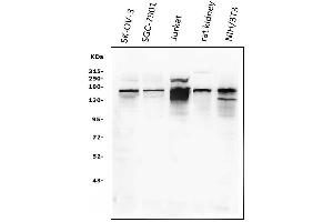 Western blot analysis of KAT13A/SRC1 using anti-KAT13A/SRC1 antibody (ABIN3042385). (NCOA1 Antikörper  (AA 614-826))
