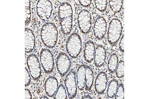 IHC analysis of SNRNP40 using anti-SNRNP40 antibody (ABIN7601719). (SNRNP40 Antikörper  (AA 43-357))