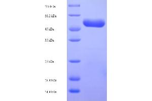 SDS-PAGE (SDS) image for Cfa/I Fimbrial Subunit E (Colonization Factor Antigen I Subunit E, Pilin Subunit) (CFAE) (AA 1-360), (full length) protein (His-SUMO Tag) (ABIN5710858)